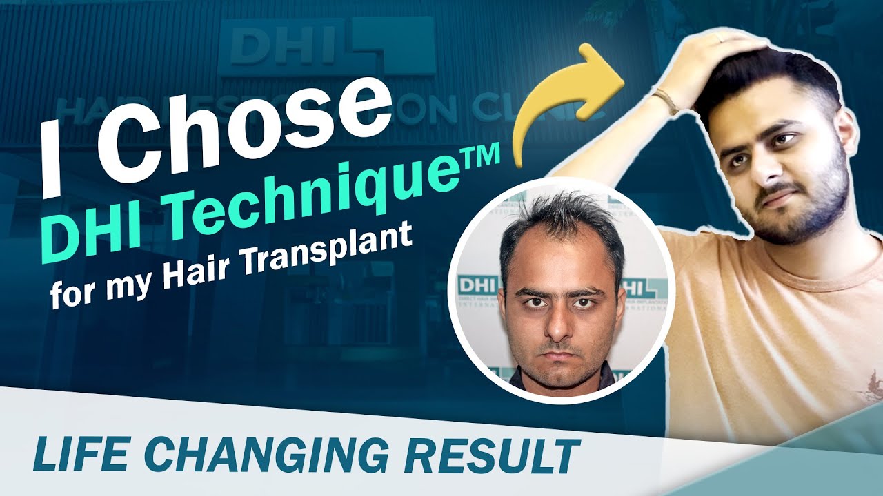 hair transplant video 1